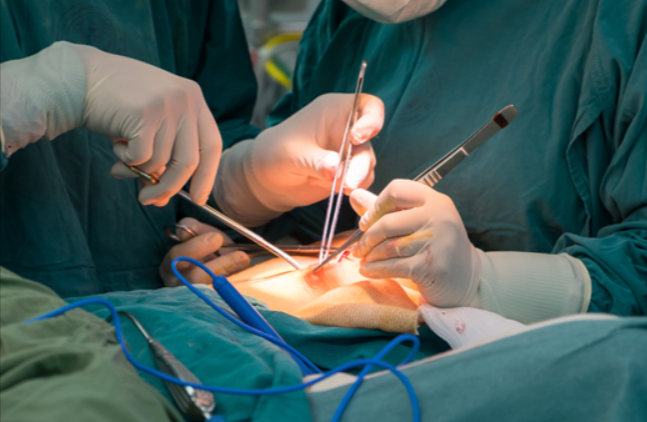 general surgery perform in operation theater